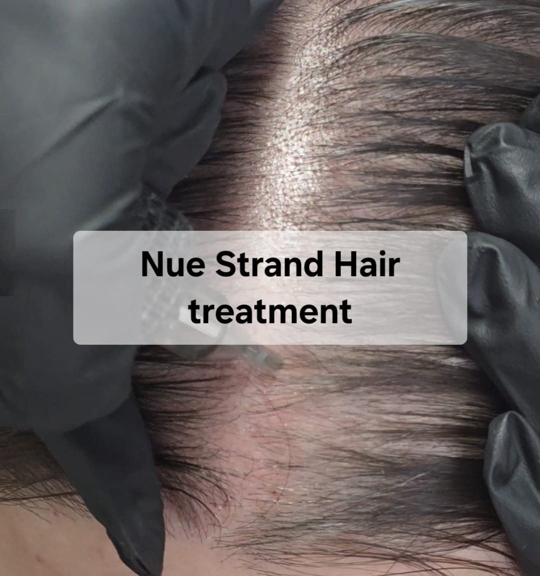 nue strand hair treatment