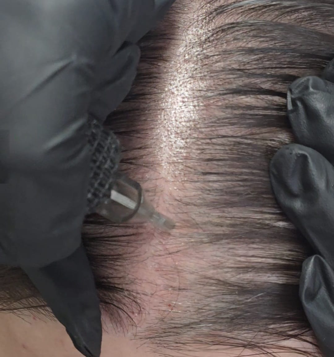 nue strand hair treatment