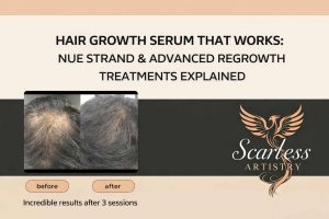 Hair growth serum treatment using Nue Strand at Scarless Artistry Sydney NSW