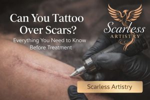 Tattoo Over Scars